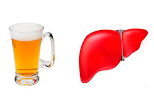 Вплив пива на печінку людини: шкода і користь даного напою, а також Чи може від нього бути цироз та інші захворювання??
