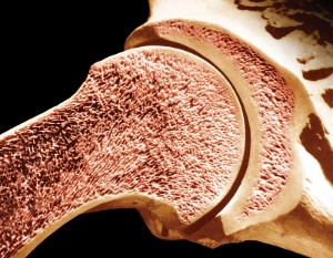 Червоний і жовтий кістковий мозок: анатомія, де він знаходиться у людини, функції і гістологія, а також корисні продукти харчування