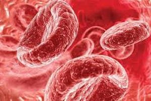 7 продуктів, що знижують гемоглобін в крові у жінок і чоловіків: якого харчування необхідно дотримуватися??